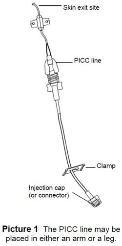 catheter