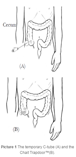 c-tube