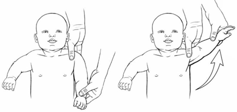 Shoulder Abduction