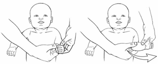 Shoulder Rotation