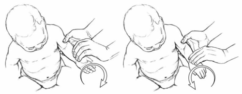 Wrist Flexion and Extension