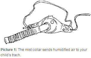 mist collar