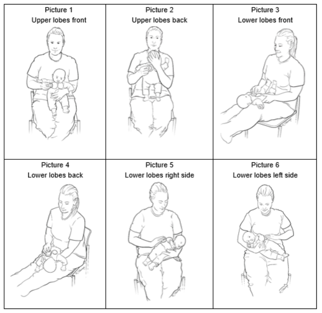 cystic fibrosis chest physiotherapy