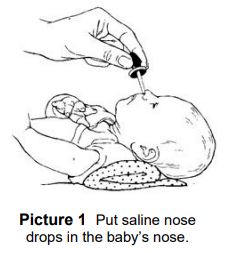 Put saline nose drops in the baby's nose.