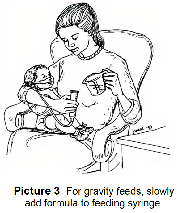 Caregiver feeding baby with gravity syringe