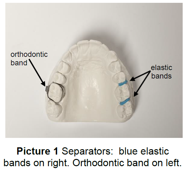 Wearing Separators