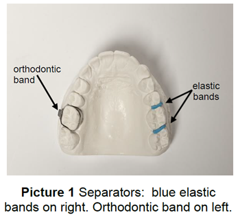 Wearing Separators