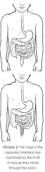 X-Ray of the Colon