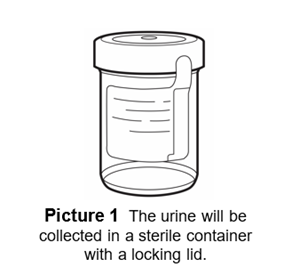 The urine will be collected in a sterile container with a locking lid.
