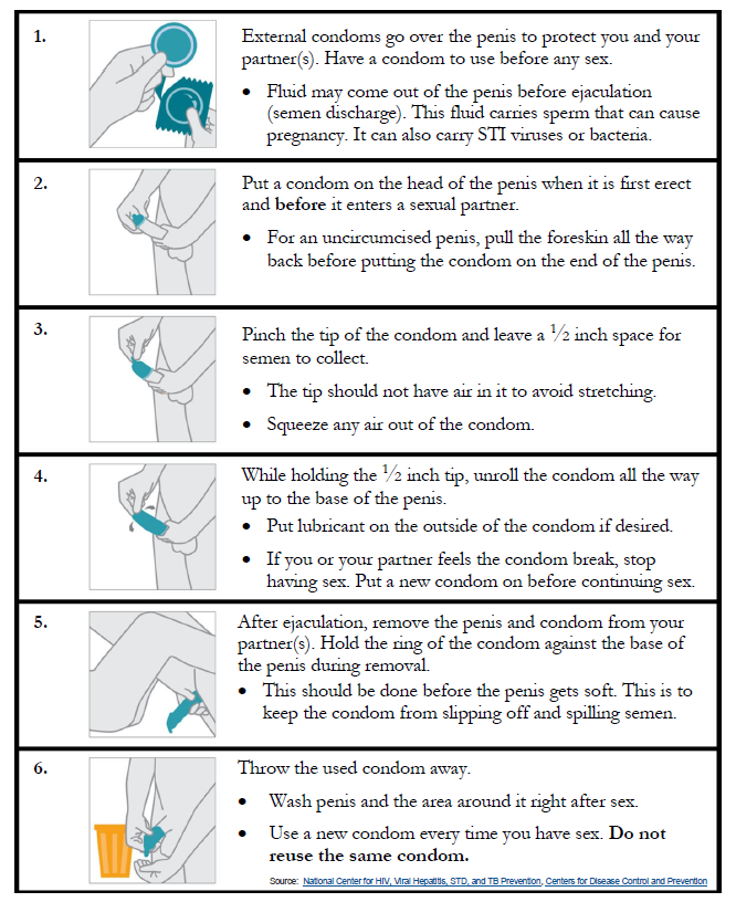 How to use an external condom