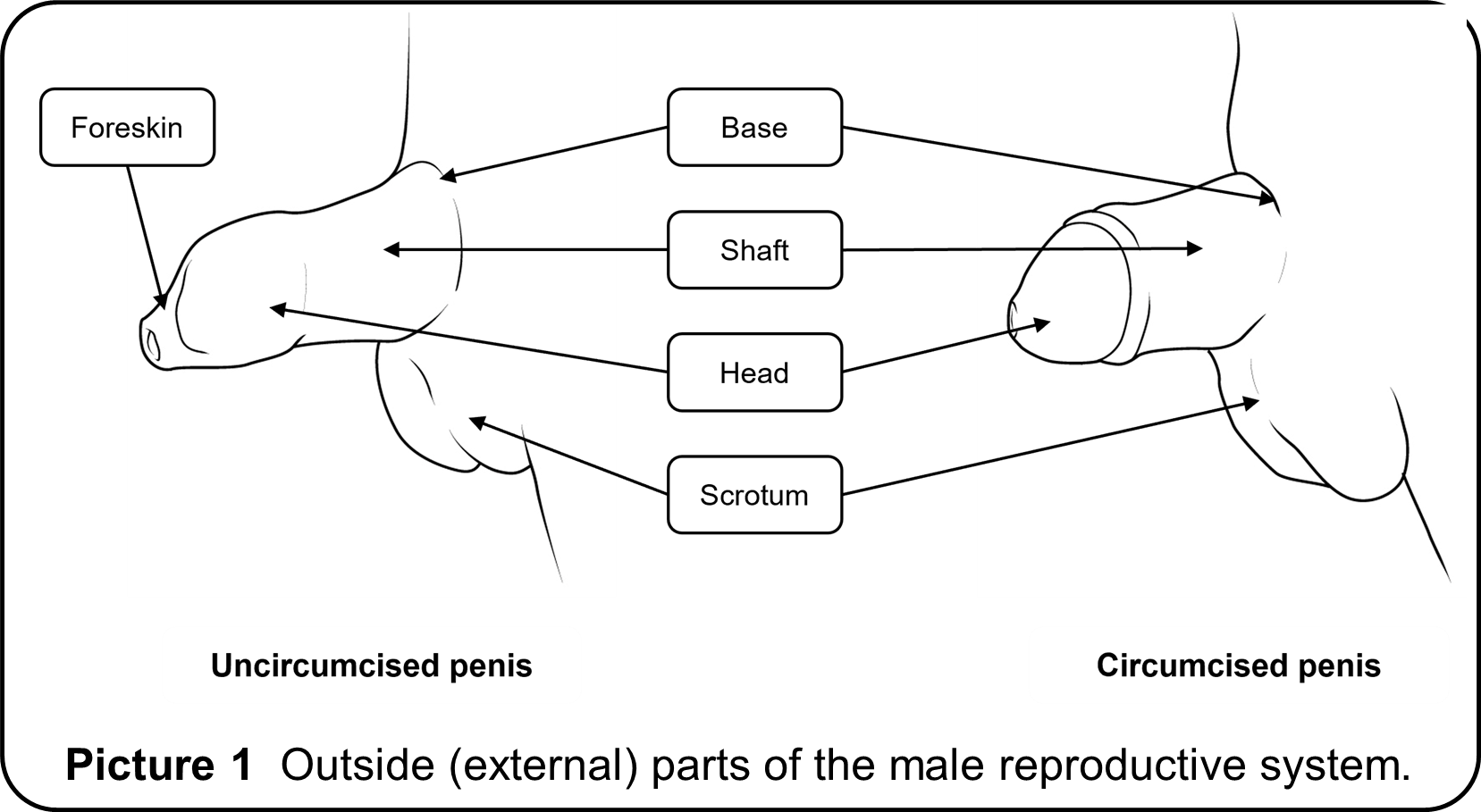 Line drawn image of a penis with reproductive organs labeled.