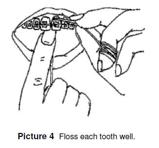 floss each tooth well