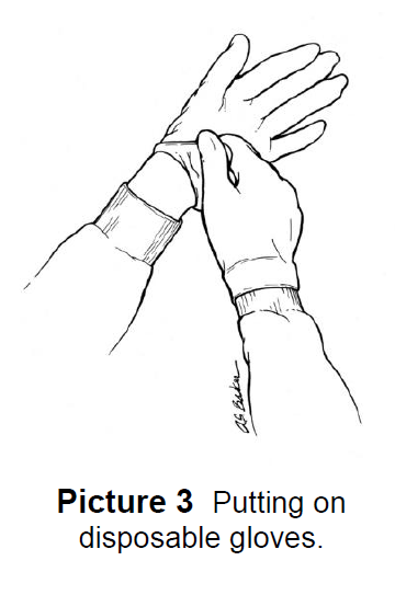 Methotrexate Injection