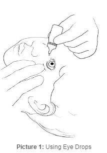 Using Eye Drops