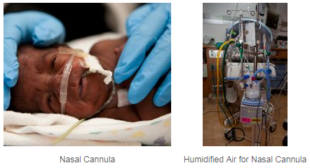cannula equipment