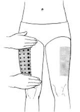 legs used for an injection site 