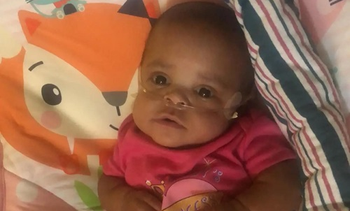 A baby girl lies on a colorful blanket, looking up at the camera with wide eyes. She wears a pink outfit and has a nasal cannula providing oxygen support.