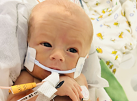 A tiny newborn rests in a neonatal intensive care unit bed, connected to monitoring equipment and respiratory support. The infant’s eyes are open, and medical sensors are attached to the chest and abdomen.