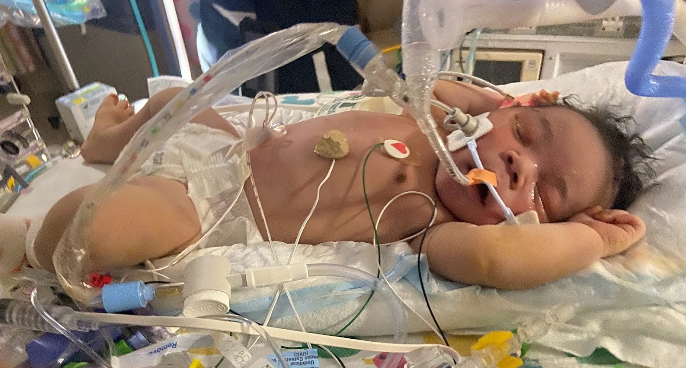 baby in hospital connected to monitors