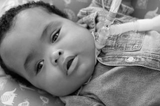 A baby lies on a patterned cushion, looking upward. The baby has a tracheostomy tube in place and is wearing a denim shirt