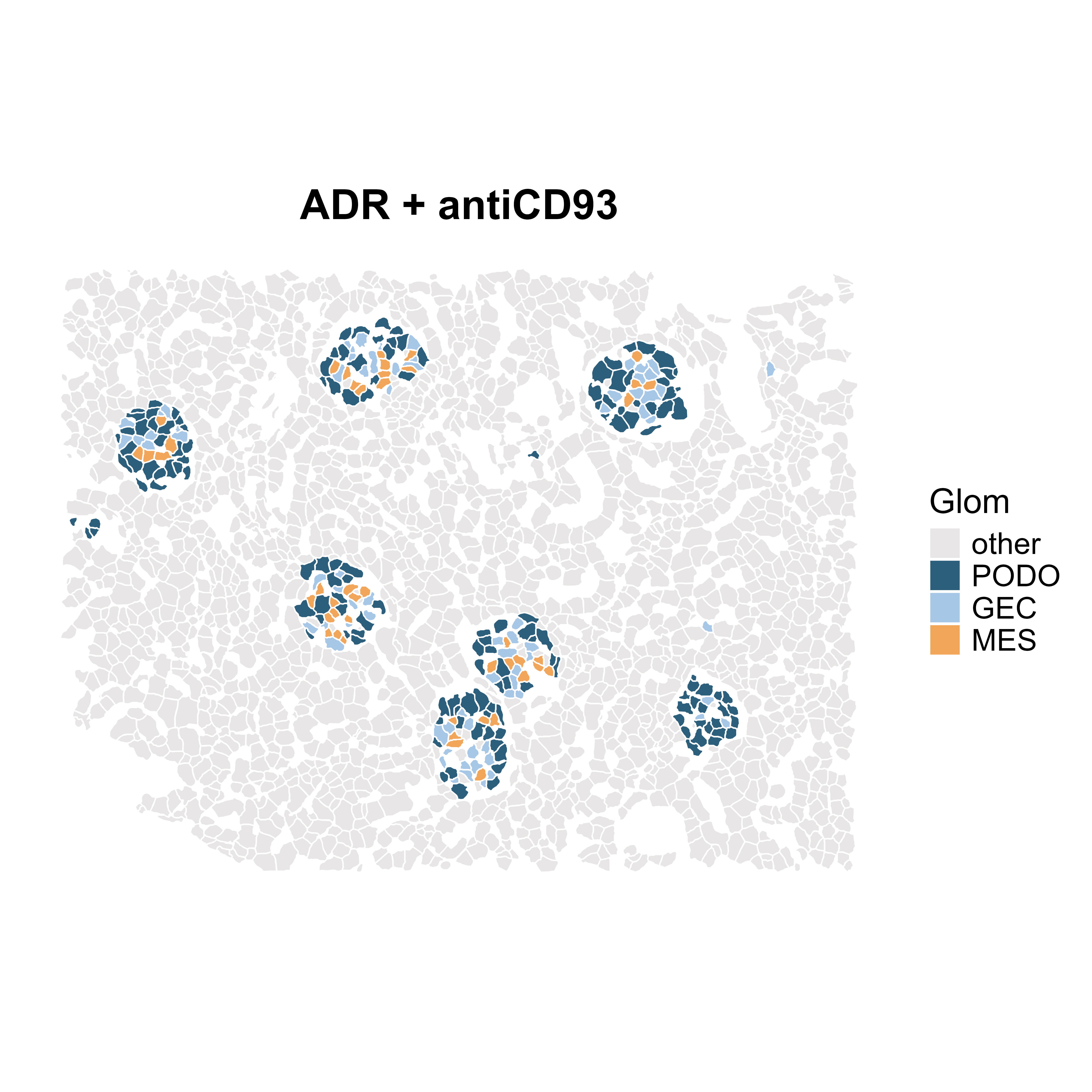 A schematic tissue map labeled “ADR + antiCD93” showing multiple glomeruli highlighted within a field of surrounding cells. Glomerular cell types are color-coded: podocytes in dark blue, glomerular endothelial cells in light blue, mesangial cells in orange, and other cells in light gray, with a legend indicating each category.