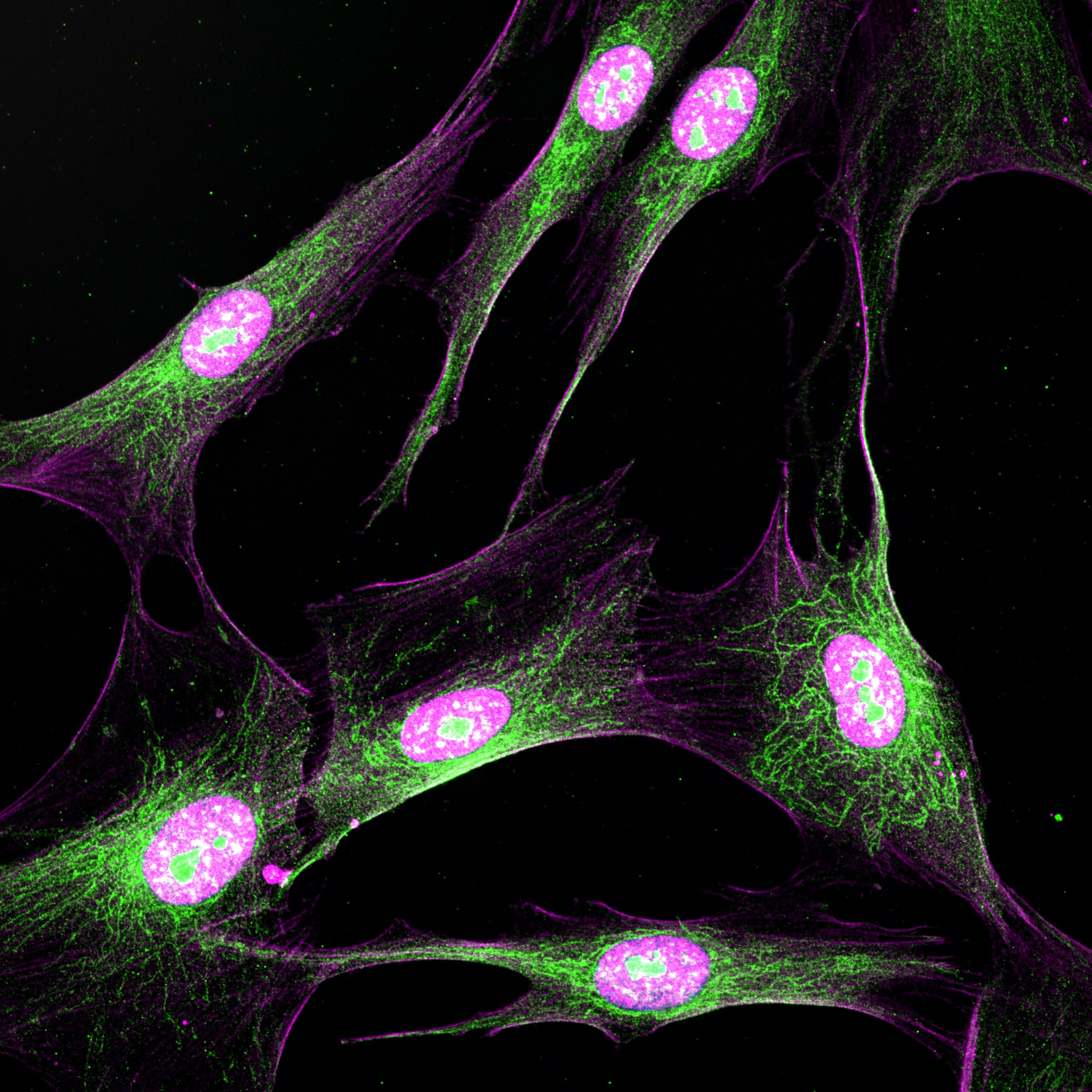 Fluorescent microscopy image of elongated cultured cells with pink‑stained nuclei and an intricate network of green filamentous structures extending throughout the cytoplasm, set against a black background.