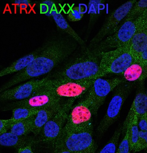 Fluorescent microscopy image of cultured cells showing distinct nuclear staining and protein localization, with ATRX labeled in red, DAXX in green, and DAPI marking cell nuclei in blue against a dark background.
