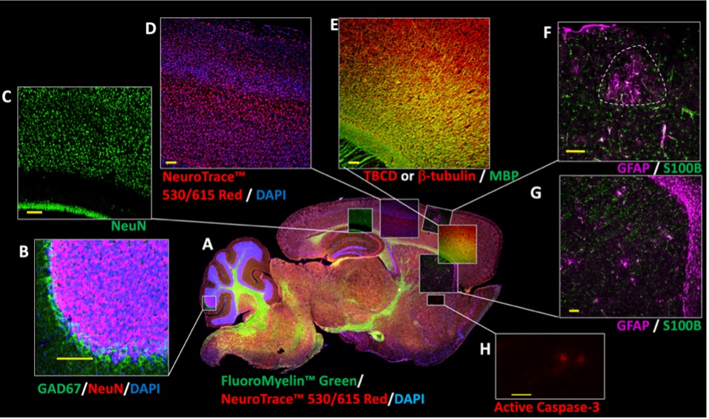 Scientific figure composed of fluorescent microscopy panels showing a sagittal mouse brain section with zoomed‑in regions labeled for neuronal, myelin, astrocyte, and active caspase‑3 markers, displayed in distinct color channels.