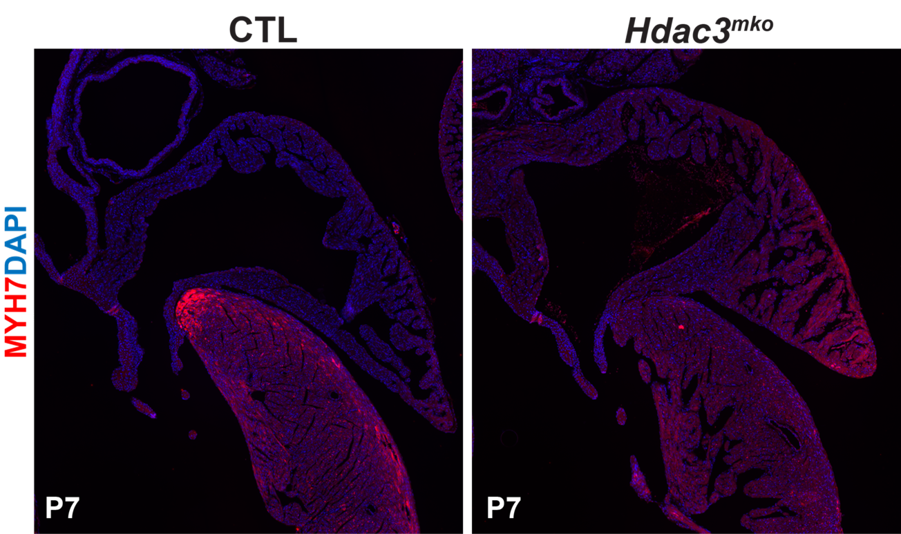 myocardial specific deletion of Hdac3 resulted in ectopic expression of Myh7 (ventricular marker gene). 