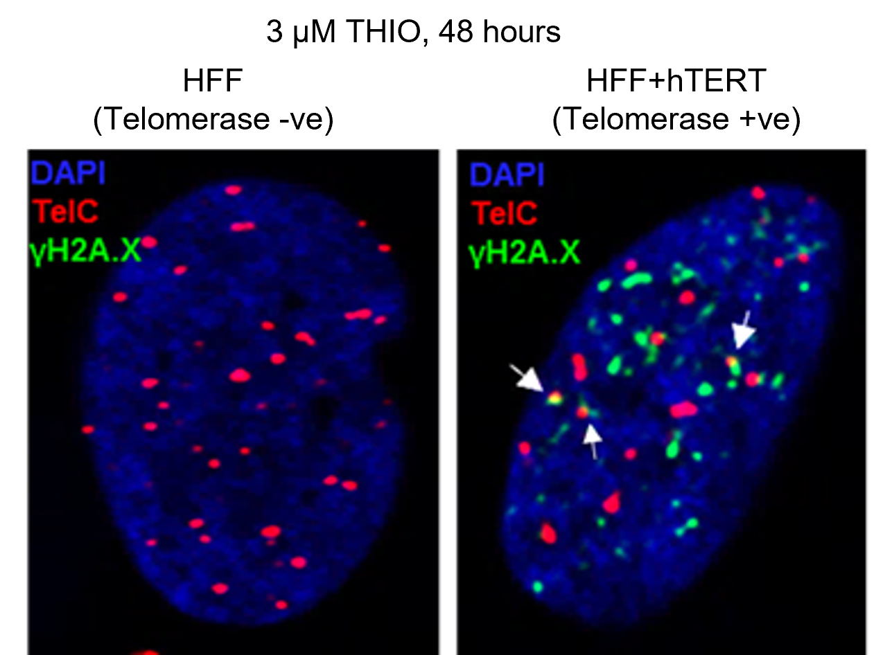 Fluorescence microscopy images comparing two cell nuclei stained with DAPI (blue), TelC (red), and γH2A.X (green). The left nucleus shows numerous red telomere signals scattered throughout a blue-stained nucleus with little to no green γH2A.X staining. The right nucleus displays both red and green signals, with several areas of overlap highlighted by white arrows. These overlapping red and green foci indicate colocalization of telomere dysfunction and DNA damage markers within the nucleus. Labels identifying DAPI, TelC, and γH2A.X appear in the upper left of each image.