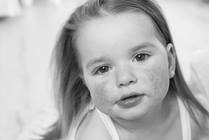 Food Allergy Treatment Center