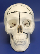 Box Osteotomy