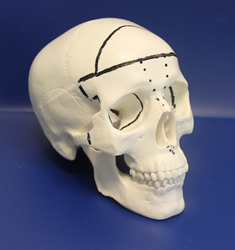 facial bipartition