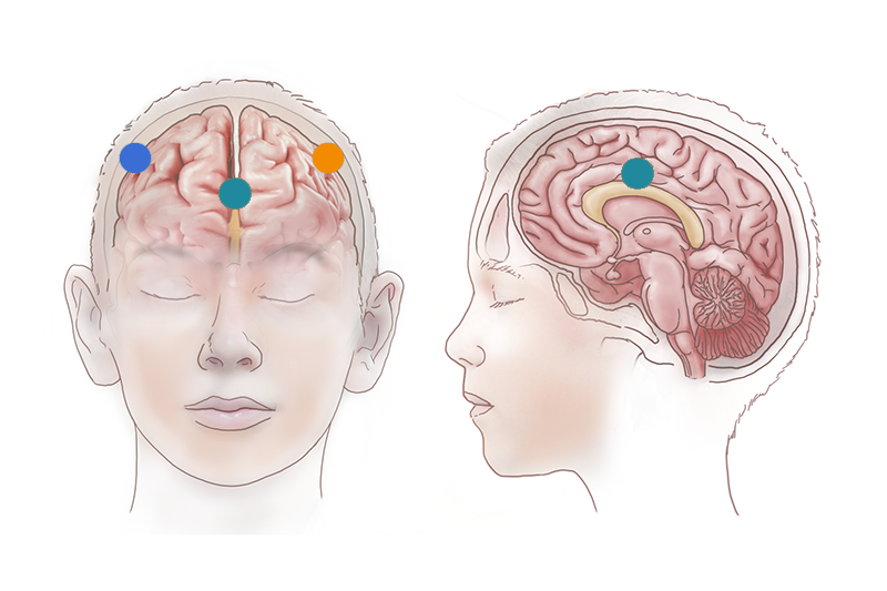  e corpus callosum connects the left and right hemispheres.