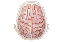 Hemispherotomy and Hemispherectomy