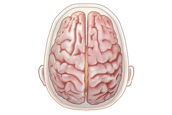 Illustration depicting the two halves (hemispheres) of the brain.