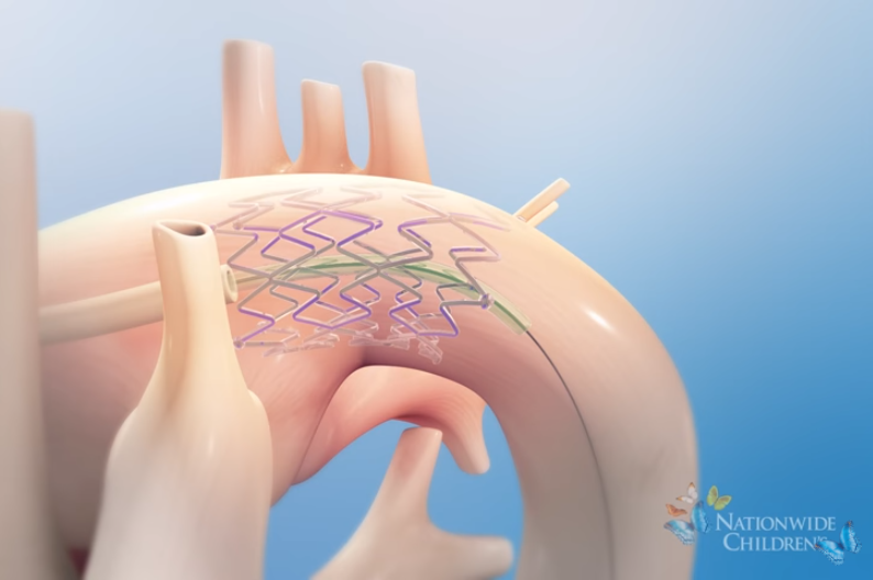 Animation: Hybrid Stage 1