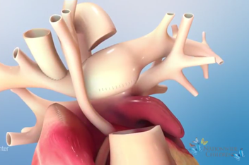 Animation: Hybrid Stage 2