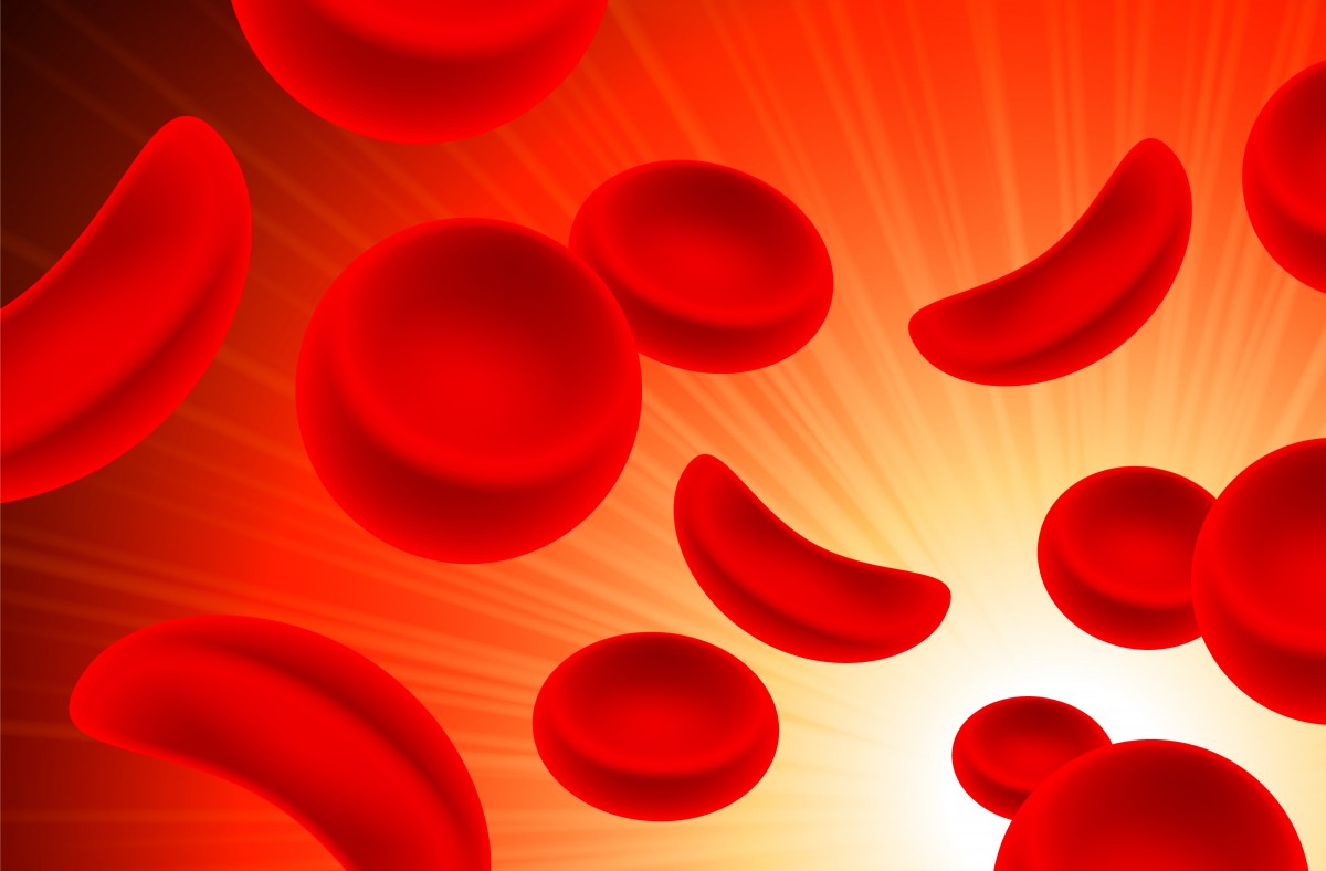 sickle cells