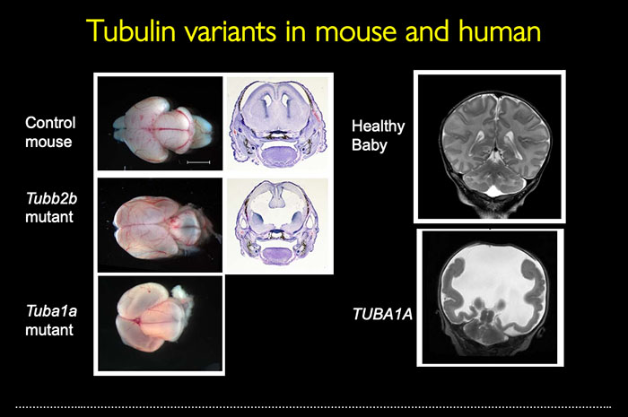 Stottmann Lab Current Projects
