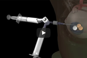 Radiology animation
