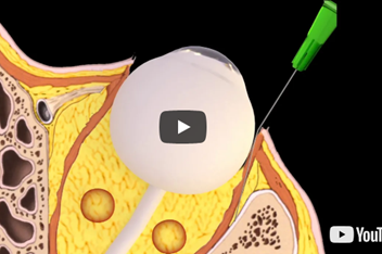Radiology animation
